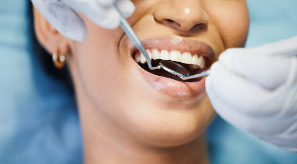 Best Emergency Gum Treatment in Union, OH