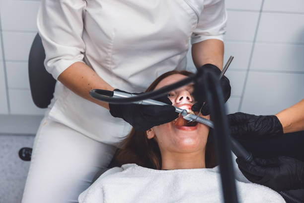 Best Emergency Wisdom Teeth Removal in Union, OH
